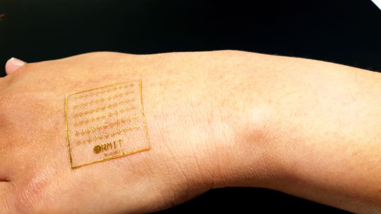 Researchers in Australia are developing artificial skin that reacts to pain